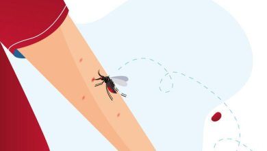 Mosquito Bite 1013 589.jpg