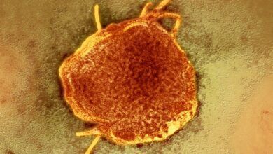 12measles Facebookjumbo.jpg