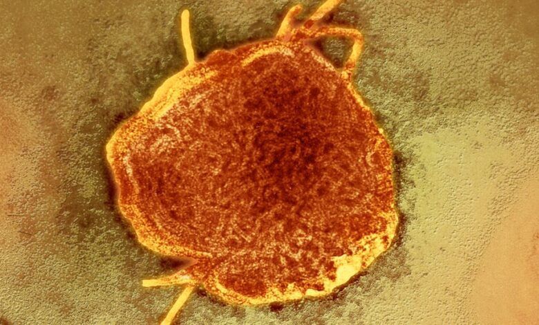 12measles Facebookjumbo.jpg