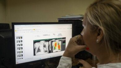 Imaging diagnose tb.jpg