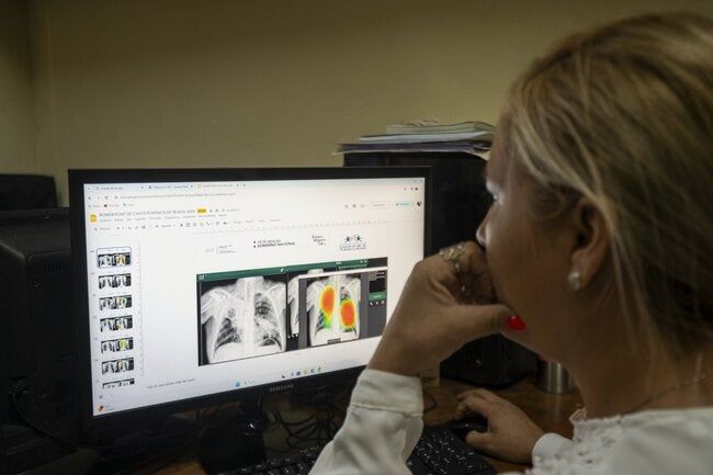 Imaging diagnose tb.jpg